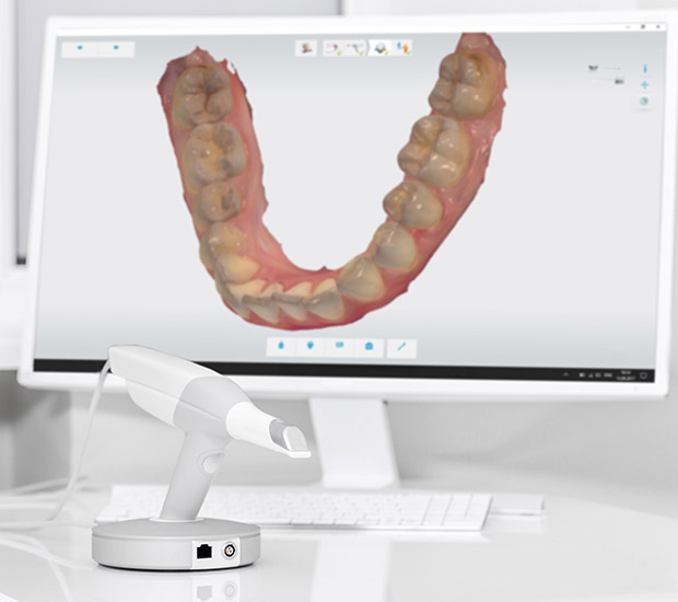 Elk Grove 3D Cone Beam and 3D Dental Scans