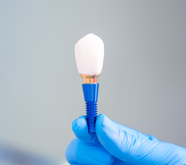 Elk Grove Dental Implant Restoration