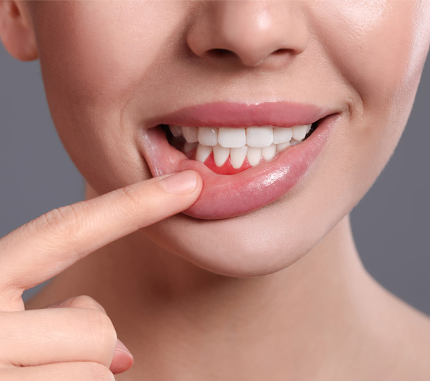 Elk Grove Gum Disease