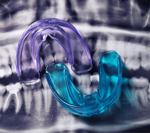 Elk Grove Mouth Guards