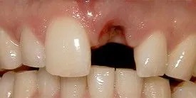 Smile Gallery