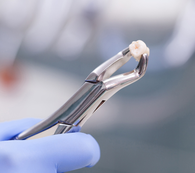 Elk Grove When Is a Tooth Extraction Necessary